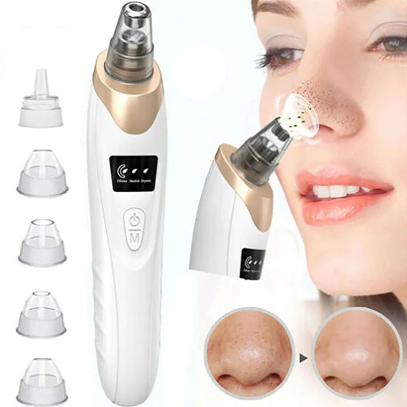 Blackhead Remover