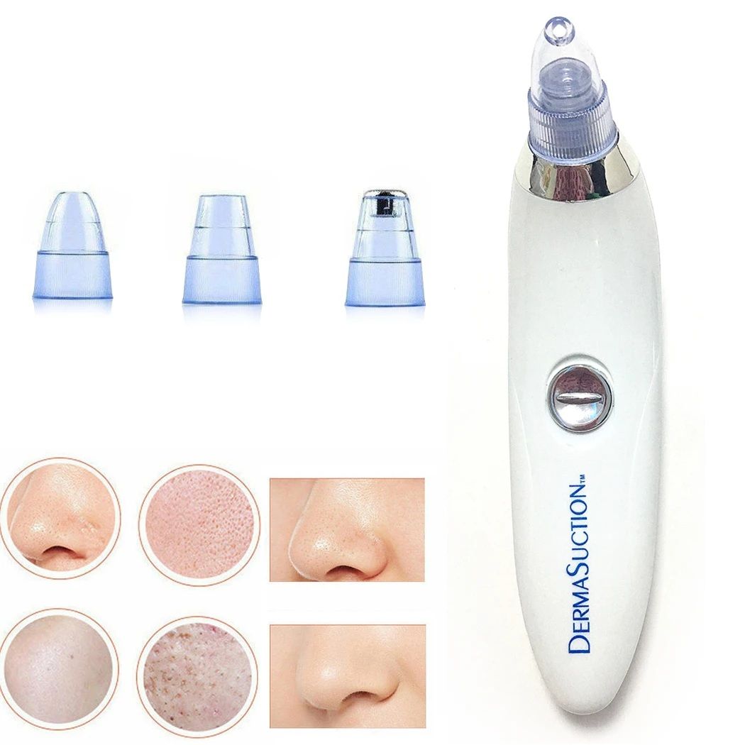 Blackhead Remover